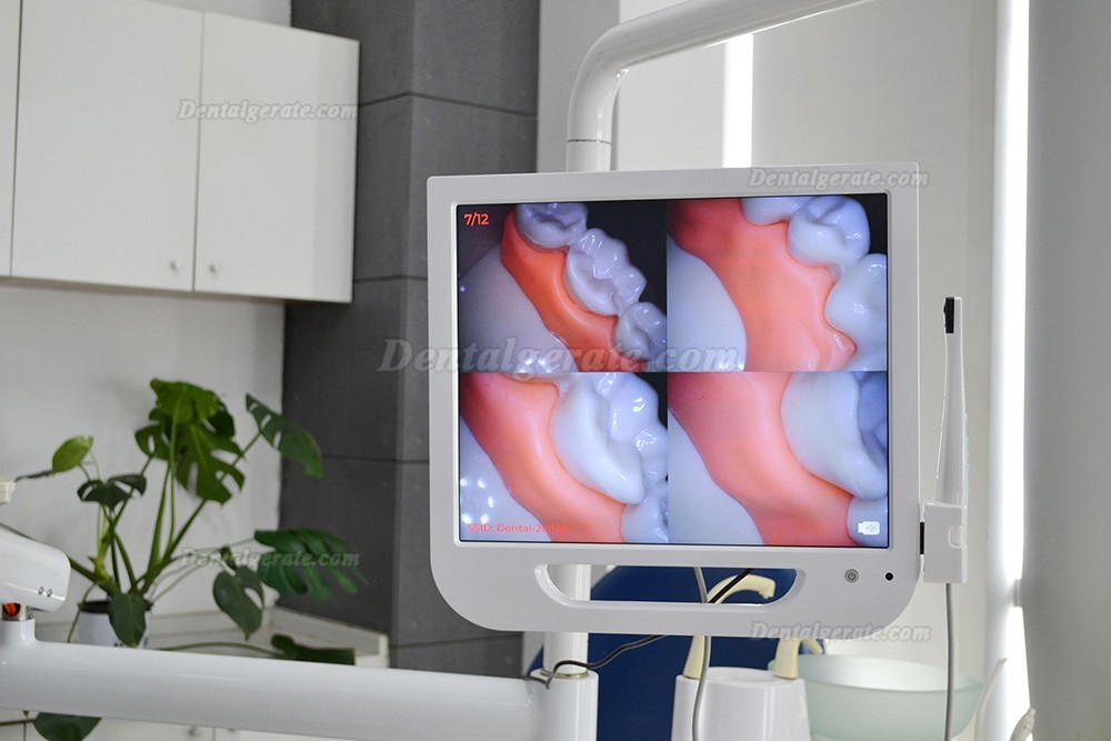 Dental Intraorale Kamera mit 17-Zoll-LCD-Monitor
